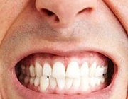 چطور استرس بر سلامتی دهان اثر می‌گذارد؟